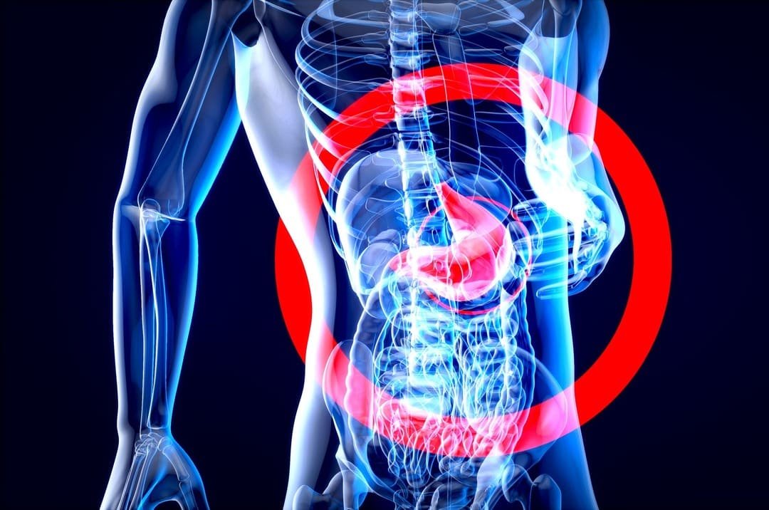 Say Goodbye to Tummy Troubles: The Ultimate Guide to Digestive Health!