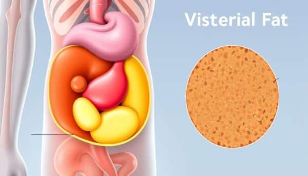 visceral fat